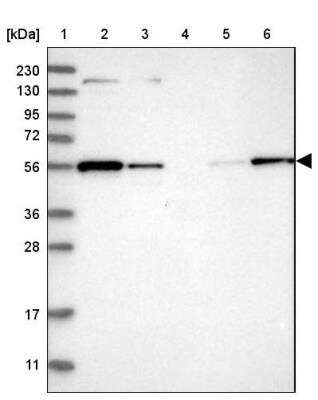 Western Blot MFSD11 Antibody - BSA Free