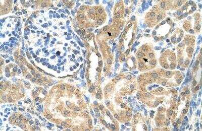 Immunohistochemistry-Paraffin: MFSD12 Antibody [NBP1-91591] - Human kidney Tissue, antibody concentration 4-8ug/ml. Cells with positive label: renal corpuscle cells (indicated with arrows) 400X magnification.