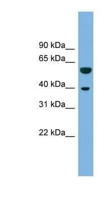 Western Blot: MFSD12 Antibody [NBP1-91590] - THP-1 cell lysate, concentration 0.2-1 ug/ml.