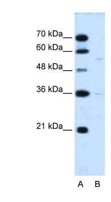Western Blot: MFSD12 Antibody [NBP1-91591] - HepG2 cell lysate, Antibody Titration: 0.2-1 ug/ml