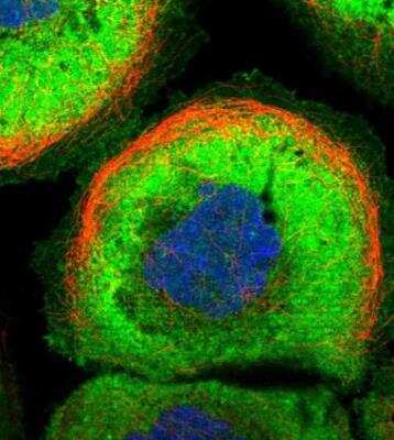 Immunocytochemistry/ Immunofluorescence MFSD2 Antibody