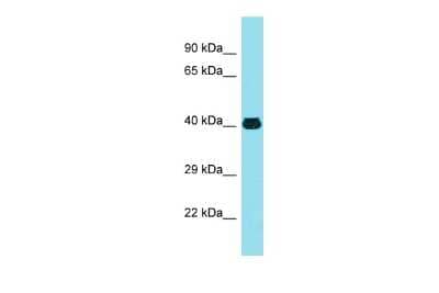 Western Blot MFSD2 Antibody