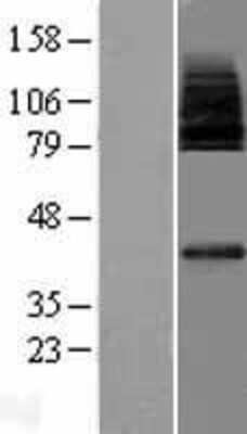 Western Blot MFSD2 Overexpression Lysate