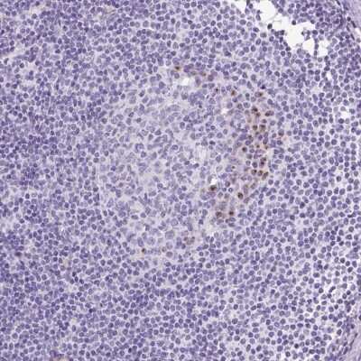 Immunohistochemistry: MFSD3 Antibody [NBP2-30815] - Staining of human lymph node shows strong positivity in subsets of germinal center cells.