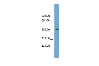 Western Blot: MFSD3 Antibody [NBP2-83199] - WB Suggested Anti-MFSD3 Antibody Titration: 0.2-1 ug/ml. Positive Control: MCF7 cell lysate