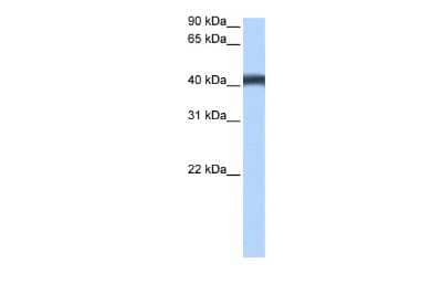 Western Blot: MFSD3 Antibody [NBP2-83200] - WB Suggested Anti-MFSD3 Antibody Titration: 0.2-1 ug/ml. Positive Control: MCF7 cell lysate