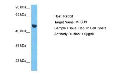 Western Blot: MFSD3 Antibody [NBP2-83201] - Host: Rabbit. Target Name: MFSD3. Sample Type: HepG2 Whole Cell lysates. Antibody Dilution: 1.0ug/ml