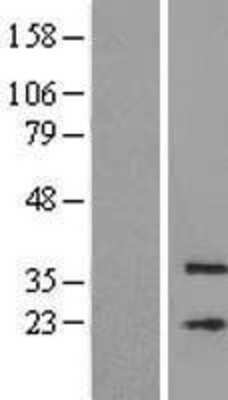 Western Blot: MFSD3 Overexpression Lysate (Adult Normal) [NBL1-13046] Left-Empty vector transfected control cell lysate (HEK293 cell lysate); Right -Over-expression Lysate for MFSD3.
