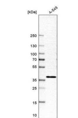 Western Blot MFSD5 Antibody