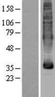 Western Blot: MFSD5 Overexpression Lysate (Adult Normal) [NBP2-04405] Left-Empty vector transfected control cell lysate (HEK293 cell lysate); Right -Over-expression Lysate for MFSD5.