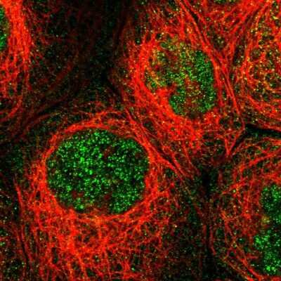 Immunocytochemistry/ Immunofluorescence MFSD6 Antibody