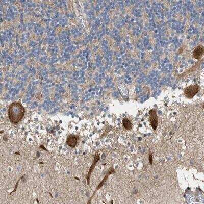 Immunohistochemistry-Paraffin MFSD6 Antibody