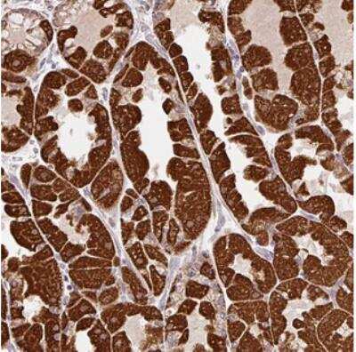 Immunohistochemistry MFSD9 Antibody