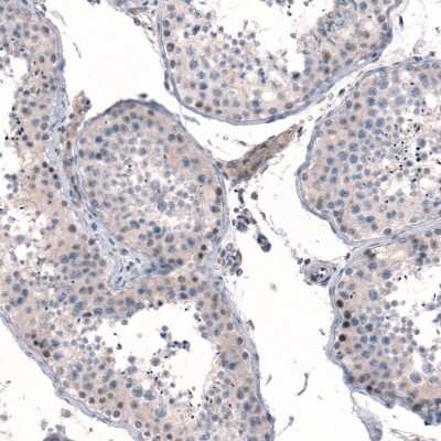 Immunohistochemistry-Paraffin MGA Antibody