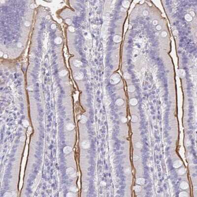 Immunohistochemistry-Paraffin: MGAM2 Antibody [NBP2-47375] - Staining of human duodenum shows high expression.