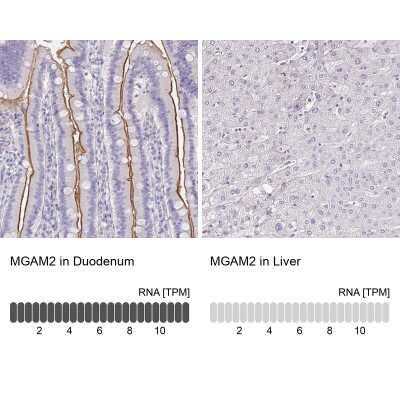 <b>Orthogonal Strategies Validation. </b>Immunohistochemistry-Paraffin: MGAM2 Antibody [NBP2-47375] - Staining in human duodenum and liver tissues using anti-MGAM2 antibody. Corresponding MGAM2 RNA-seq data are presented for the same tissues.