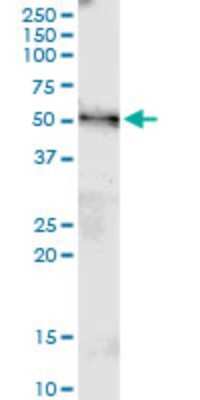 Western Blot: MGAT4B Antibody (1F4) [H00011282-M01] - MGAT4B monoclonal antibody (M01), clone 1F4. Analysis of MGAT4B expression in human pancreas.