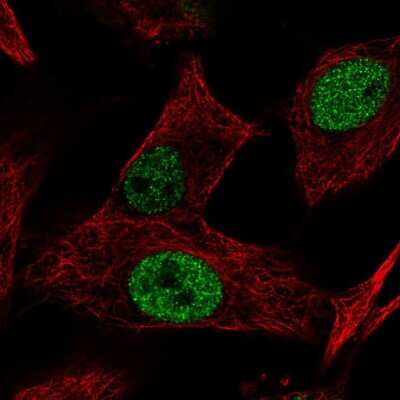 Immunocytochemistry/ Immunofluorescence MGAT5B Antibody