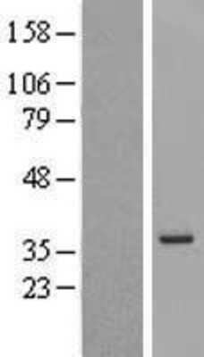 Western Blot: MGC12965 Overexpression Overexpression Lysate (Adult Normal) [NBL1-13057] Left-Empty vector transfected control cell lysate (HEK293 cell lysate); Right -Over-expression Lysate for MGC12965 Overexpression.