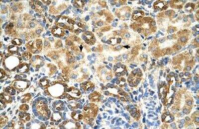 Immunohistochemistry-Paraffin: MGC16471 Antibody [NBP1-79269] - Human kidney Tissue, antibody concentration 4-8ug/ml. Cells with positive label: renal corpuscle cells (indicated with arrows) 400X magnification.