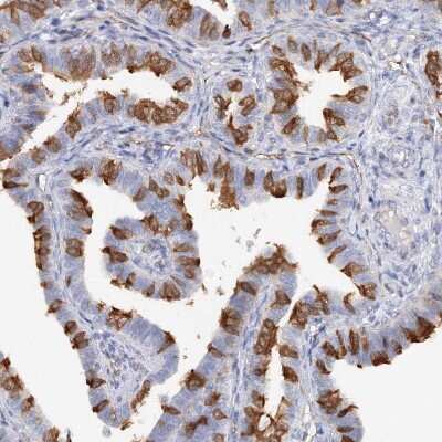 Immunohistochemistry-Paraffin: MGC16471 Antibody [NBP1-88005] - Staining of human fallopian tube shows strong cytoplasmic positivity in glandular cells.