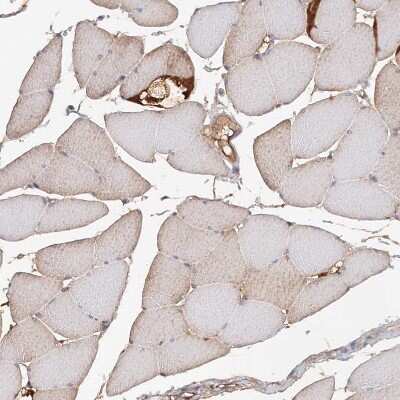 Immunohistochemistry-Paraffin: MGC16471 Antibody [NBP1-88005] - Staining of human skeletal muscle shows moderate cytoplasmic positivity in myocytes.