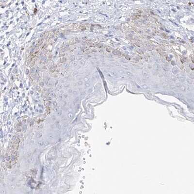 Immunohistochemistry-Paraffin: MGC16471 Antibody [NBP1-88005] - Staining of human skin shows weak granular cytoplasmic positivity in squamous epithelial cells.