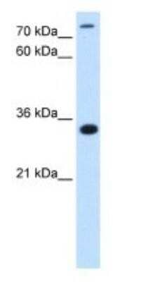 Western Blot: MGC16471 Antibody [NBP1-79269] - HepG2 cell lysate, concentration 2.5 ug/ml.