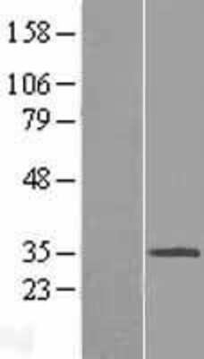 Western Blot: MGC16471 Overexpression Lysate (Adult Normal) [NBP2-05625] Left-Empty vector transfected control cell lysate (HEK293 cell lysate); Right -Over-expression Lysate for MGC16471.