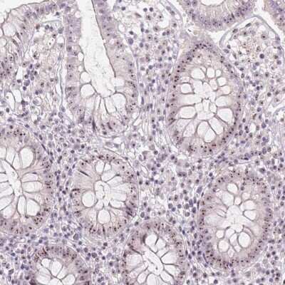 Immunohistochemistry-Paraffin MGC20410 Antibody - BSA Free
