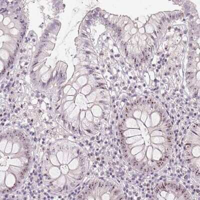 Immunohistochemistry-Paraffin MGC20410 Antibody - BSA Free