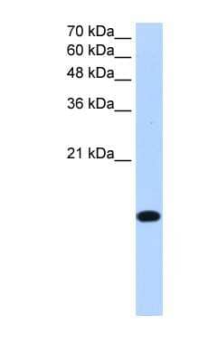 Western Blot: MGC20410 Antibody [NBP1-79267] - HepG2 cell lysate, concentration 0.2-1 ug/ml.