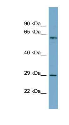 Western Blot: MGC20410 Antibody [NBP1-79268] - PANC1 cell lysate, concentration 0.2-1 ug/ml.