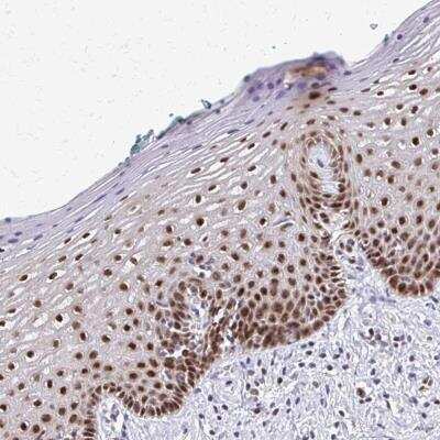 Immunohistochemistry-Paraffin: MGC2803 Antibody [NBP2-31806] - Staining of human vagina shows strong nuclear positivity in squamous epithelial cells.