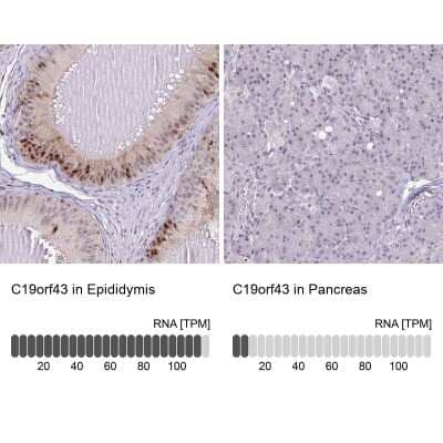 Immunohistochemistry-Paraffin: MGC2803 Antibody [NBP2-31806] - Analysis in human epididymis and pancreas tissues using NBP2-31806 antibody. Corresponding MGC2803 RNA-seq data are presented for the same tissues.
