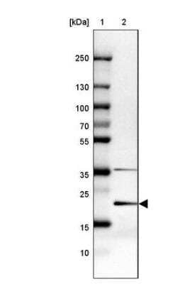 Western Blot: MGC2803 Antibody [NBP2-31806] - Lane 1: Marker [kDa] 250, 130, 100, 70, 55, 35, 25, 15, 10Lane 2: Human cell line MCF-7