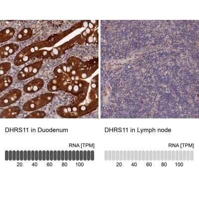 Immunohistochemistry-Paraffin: MGC4172 Antibody [NBP2-30446] - Analysis in human duodenum and lymph node tissues using NBP2-30446 antibody. Corresponding DHRS11 RNA-seq data are presented for the same tissues.