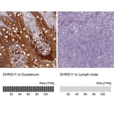 <b>Orthogonal Strategies Validation. </b>Immunohistochemistry-Paraffin: MGC4172 Antibody [NBP2-30686] - Staining in human duodenum and lymph node tissues using anti-DHRS11 antibody. Corresponding DHRS11 RNA-seq data are presented for the same tissues.