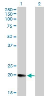 Western Blot: MGC4172 Antibody [H00079154-B01P] - Analysis of DHRS11 expression in transfected 293T cell line by DHRS11 polyclonal antibody.  Lane 1: MGC4172 transfected lysate(20.02 KDa). Lane 2: Non-transfected lysate.