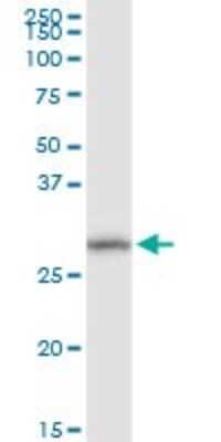 Western Blot: MGC4172 Antibody [H00079154-D01P] - Analysis of DHRS11 expression in mouse intestine.