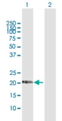 Western Blot: MGC4172 Antibody [H00079154-D01P] - Analysis of DHRS11 expression in transfected 293T cell line by DHRS11 polyclonal antibody.Lane 1: DHRS11 transfected lysate(20.00 KDa).Lane 2: Non-transfected lysate.