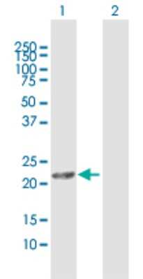 Western Blot: MGC4172 Antibody [H00079154-D02P] - Analysis of MGC4172 expression in transfected 293T cell line by MGC4172 polyclonal antibody.Lane 1: MGC4172 transfected lysate(20.02 KDa).Lane 2: Non-transfected lysate.
