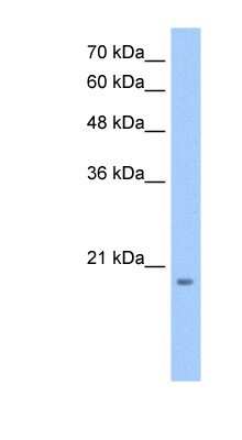 Western Blot: MGC4172 Antibody [NBP1-60061] - HepG2 cell lysate, concentration 0.2-1 ug/ml.