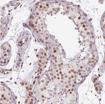 Immunohistochemistry-Paraffin: MGC4618 Antibody [NBP2-49247] - Staining of human testis shows moderate positivity in nuclear membrane in cells in seminiferous ducts and leydig cells.