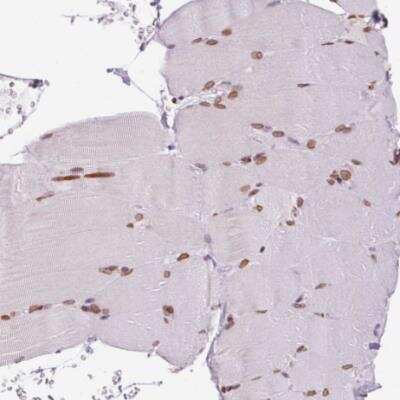 Immunohistochemistry-Paraffin: MGC4618 Antibody [NBP2-49247] - Staining of human skeletal muscle shows moderate positivity in nuclear membrane in myocytes.