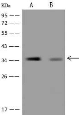 Western Blot: MGME1 Antibody [NBP3-12644] - Lane A: HepG2 Whole Cell LysateLane B: RT4 Whole Cell LysateLysates/proteins at 30 ug per lane.SecondaryGoat Anti-Rabbit IgG (H+L)/HRP at 1/10000 dilution.Developed using the ECL technique.Performed under reducing conditions.Predicted band size:39 kDaObserved band size:35 kDa
