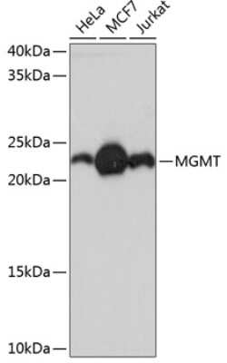 Western Blot: MGMT Antibody (2A4X3) [NBP3-15348] - Western blot analysis of extracts of various cell lines, using MGMT Rabbit mAb (NBP3-15348) at 1:1000 dilution. Secondary antibody: HRP Goat Anti-Rabbit IgG (H+L) at 1:10000 dilution. Lysates/proteins: 25ug per lane. Blocking buffer: 3% nonfat dry milk in TBST. Detection: ECL Basic Kit. Exposure time: 30s.