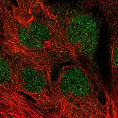 Immunocytochemistry/Immunofluorescence: MGMT Antibody [NBP2-58611] - Staining of human cell line CACO-2 shows localization to nucleoplasm.