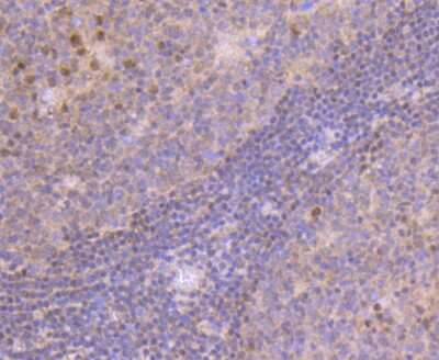 Immunohistochemistry-Paraffin: MGMT Antibody (JJ089-6) [NBP2-67880] - Analysis of paraffin-embedded human tonsil tissue using anti-MGMT antibody. Counter stained with hematoxylin.