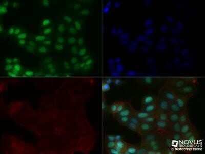 Immunocytochemistry/Immunofluorescence: MGMT Antibody (MT 23.2) - Azide and BSA Free [NBP2-80847] - MCF7 cells were fixed for 10 minutes using 10% formalin and then permeabilized for 5 minutes using 1X TBS + 0.5% Triton-X100. The cells were incubated with anti-MGMT (MT 23.2) NB100-168 at a 1:200 dilution overnight at 4C and detected with an anti-mouse Dylight 488 (Green) at a 1:500 dilution. Actin was counterstained with Phalloidin 568 (Red) at a 1:200 dilution. Nuclei were counterstained with DAPI (Blue). Cells were imaged using a 40X objective. Image from the standard format of this antibody.